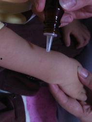 叮毒图片,揭秘病毒入侵的惊心动魄瞬间